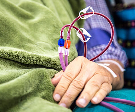 人工透析のご案内